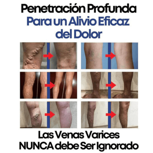KIT VeinRelief: Piernas sanas ¡Días sin dolor!