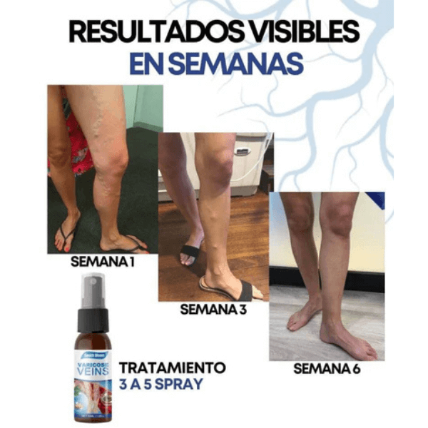 KIT VeinRelief: Piernas sanas ¡Días sin dolor!